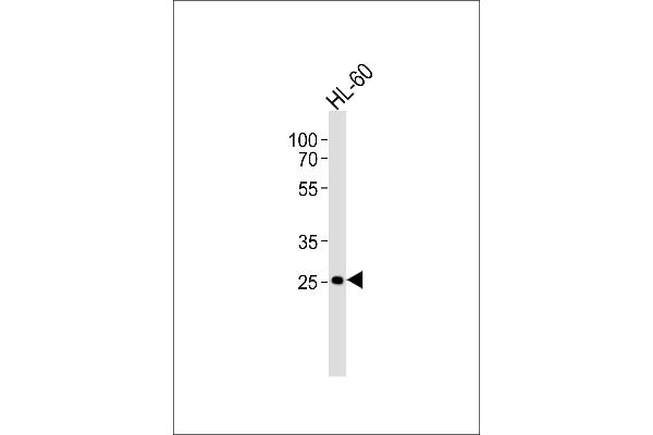 FCGR3B Antikörper  (N-Term)