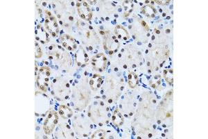 Immunohistochemistry of paraffin-embedded rat kidney using CCAR2 antibody (ABIN2563550) at dilution of 1:100 (40x lens). (CCAR2 Antikörper)