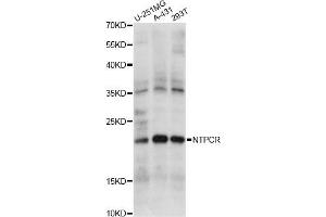 Western blot analysis of extracts of various cell lines, using NTPCR antibody. (C1orf57 Antikörper)