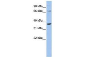 Image no. 1 for anti-Zinc Finger Protein 274 (ZNF274) (C-Term) antibody (ABIN6742908) (ZNF274 Antikörper  (C-Term))