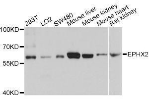 Western blot analysis of extracts of various cell lines, using EPHX2 antibody (ABIN5970967) at 1/1000 dilution. (EPHX2 Antikörper)