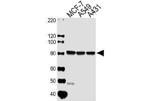 Lane 1: MCF-7 Cell lysates, Lane 2: A549 Cell lysates, Lane 3: A431 Cell lysates, probed with CAPN1 (1376CT809. (CAPNL1 Antikörper)