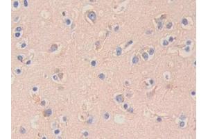 Detection of HEXb in Human Cerebrum Tissue using Polyclonal Antibody to Hexosaminidase B Beta (HEXb)