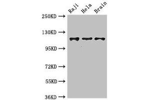 Western Blot Positive WB detected in: Raji whole cell lysate, Hela whole cell lysate, Mouse brain tissue All lanes: KIF11 antibody at 3. (KIF11 Antikörper  (AA 920-1038))
