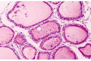 Human Thyroid: Formalin-Fixed, Paraffin-Embedded (FFPE) (PAK2 Antikörper  (C-Term))