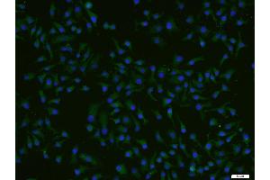 HepG2 cells were stained with ADCK4 Polyclonal Antibody, Unconjugated (bs-8070R) at 1:200 and incubated for 90 minutesat room temperature, followed by secondary antibody incubation, DAPI staining of the nuclei and detection. (ADCK4 Antikörper  (AA 65-170))