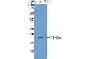 Detection of Recombinant KRT19, Human using Polyclonal Antibody to Cytokeratin 19 (CK19) (Cytokeratin 19 Antikörper  (AA 245-391))