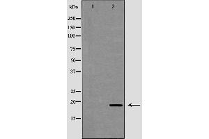 Western blot analysis of extracts of mouse liver, using CAMP antibody. (Cathelicidin Antikörper  (Internal Region))