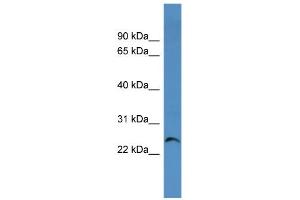WB Suggested Anti-Cacng1 Antibody Titration:  0. (CACNG1 Antikörper  (Middle Region))