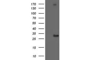 Western Blotting (WB) image for anti-Regulatory Factor X-Associated Ankyrin Containing Protein (RFXANK) antibody (ABIN1500682) (RFXANK Antikörper)