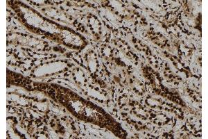 ABIN6279801 at 1/100 staining Human kidney tissue by IHC-P. (ULK2 Antikörper  (Internal Region))