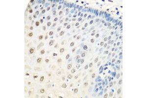 Immunohistochemistry of paraffin-embedded human esophagus using HNRNPA0 antibody at dilution of 1:100 (40x lens).