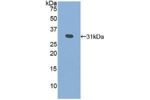 Western blot analysis of recombinant Human GLa. (GLA Antikörper  (AA 147-371))
