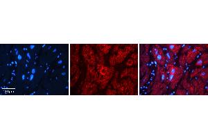 Rabbit Anti-AK1 Antibody   Formalin Fixed Paraffin Embedded Tissue: Human heart Tissue Observed Staining: Cytoplasmic Primary Antibody Concentration: N/A Other Working Concentrations: 1:600 Secondary Antibody: Donkey anti-Rabbit-Cy3 Secondary Antibody Concentration: 1:200 Magnification: 20X Exposure Time: 0. (Adenylate Kinase 1 Antikörper  (N-Term))