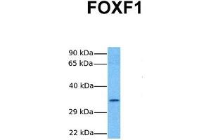 Host:  Rabbit  Target Name:  FOXF1  Sample Tissue:  Human Hela  Antibody Dilution:  1. (FOXF1 Antikörper  (C-Term))