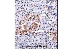 CUGBP1 Antibody (N-term) ((ABIN657957 and ABIN2846902))immunohistochemistry analysis in formalin fixed and paraffin embedded human pancreas tissue followed by peroxidase conjugation of the secondary antibody and DAB staining.