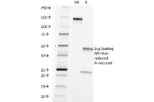 SDS-PAGE Analysis Purified TAG-72 Mouse Monoclonal Antibody (B72. (TAG-72 / CA72.4 Antikörper)