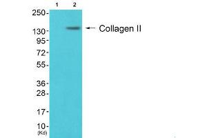 Western Blotting (WB) image for anti-Collagen, Type II (COL2) (N-Term) antibody (ABIN1848474) (COL2 Antikörper  (N-Term))