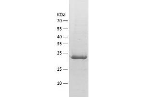 Western Blotting (WB) image for Methylmalonic Aciduria (Cobalamin Deficiency) CblB Type (MMAB) (AA 33-250) protein (His tag) (ABIN7123940) (MMAB Protein (AA 33-250) (His tag))