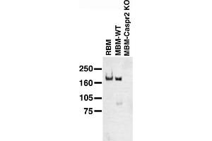 Immunoblot on adult rat brain membrane (RBM), and adult mouse brain membranes (MBM) from wild-type (WT) and Caspr2 knockout mice. (CNTNAP2 Antikörper  (Extracellular))