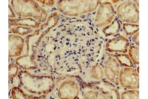 Immunohistochemistry of paraffin-embedded human kidney tissue using ABIN7170416 at dilution of 1:100 (SP11 (AA 137-386) Antikörper)