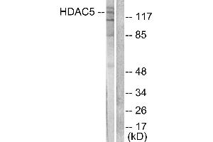 Western blot analysis of extracts from HepG2 cells, treated with PMA (125ng/ml, 30mins), using HDAC5 antibody (#C0225). (HDAC5 Antikörper)