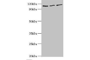 Western blot All lanes: MERTK antibody at 8 μg/mL Lane 1: Mouse gonad tissue Lane 2: Mouse lung tissue Lane 3: Mouse kidney tissue Secondary Goat polyclonal to rabbit IgG at 1/10000 dilution Predicted band size: 110 kDa Observed band size: 110 kDa (MERTK Antikörper  (AA 840-999))