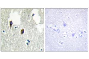 Immunohistochemistry analysis of paraffin-embedded human brain tissue, using KLHL3 antibody. (KLHL3 Antikörper  (N-Term))