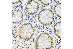 Immunohistochemistry of paraffin-embedded human colon using SNRPE Antibody (ABIN1876676) at dilution of 1:200 (40x lens). (SNRPE Antikörper)