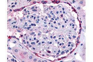 Anti-EPHA4 antibody IHC of human kidney, glomerulus. (EPH Receptor A4 Antikörper  (Internal Region))