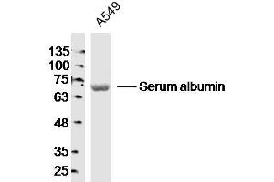 A549 lysates probed with Serum albumin Polyclonal Antibody, Unconjugated  at 1:300 dilution and 4˚C overnight incubation. (Albumin Antikörper)
