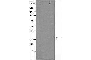 Western blot analysis on MCF7 cell lysate using BCL-2 Antibody，The lane on the left is treated with the antigen-specific peptide. (Bcl-2 Antikörper  (Internal Region))