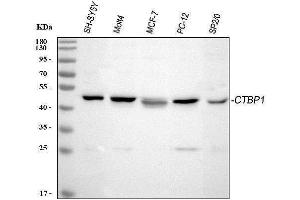 Western blot analysis of CTBP1 using anti-CTBP1 antibody (ABIN3043816). (CTBP1 Antikörper  (C-Term))