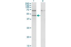 Western Blot analysis of STRADB expression in transfected 293T cell line by STRADB monoclonal antibody (M02), clone 3E11. (STRADB Antikörper  (AA 319-418))