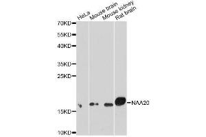 Western blot analysis of extracts of various cell lines, using NAA20 antibody. (NAT5 Antikörper  (AA 49-178))