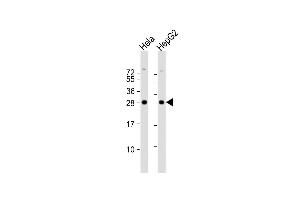 All lanes : Anti-M2 Antibody (C-term) at 1:1000 dilution Lane 1: Hela whole cell lysate Lane 2: HepG2 whole cell lysate Lysates/proteins at 20 μg per lane. (PMM2 Antikörper  (C-Term))