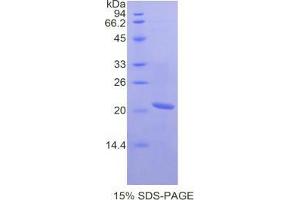SDS-PAGE analysis of Mouse SCCA2 Protein.