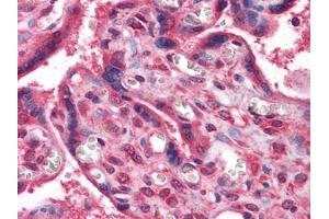 Immunohistochemical analysis of paraffin-embedded human Placenta tissues using anti-NME1 antibody (NME1 Antikörper)