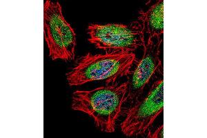 Immunofluorescence (IF) image for anti-SP140 Nuclear Body Protein (SP140) antibody (ABIN2997006) (SP140 Antikörper)