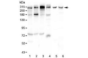 Western blot testing of human 1) HeLa, 2) U-87 MG, 3) HepG2, 4) 22RV1, 5) rat brain and 6) mouse brain lysate with M6PR antibody at 0.