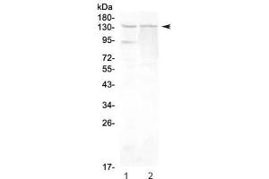 Western blot testing of rat 1) testis and 2) PC-12 lysate with RTEL1 antibody at 0. (RTEL1 Antikörper)