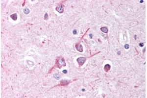 Human Brain, Cortex (formalin-fixed, paraffin-embedded) stained with AFF1 antibody ABIN214636 at 10 ug/ml followed by biotinylated goat anti-rabbit IgG secondary antibody ABIN481713, alkaline phosphatase-streptavidin and chromogen. (AF4 Antikörper  (AA 1190-1203))