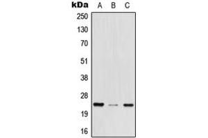 Western blot analysis of MED29 expression in HEK293T (A), mouse brain (B), rat lung (C) whole cell lysates.