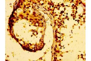 Immunohistochemistry (IHC) image for anti-Matrix Metallopeptidase 28 (MMP28) (AA 351-475) antibody (ABIN7159070)