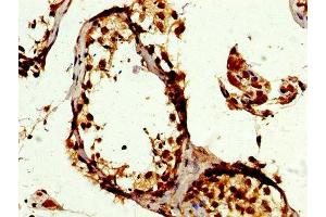 Immunohistochemistry (IHC) image for anti-Polymerase (DNA-Directed), delta 3, Accessory Subunit (POLD3) (AA 203-275) antibody (ABIN7150235)