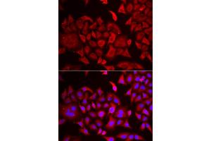 Immunofluorescence analysis of HeLa cells using TARS antibody (ABIN6132713, ABIN6148858, ABIN6148859 and ABIN6222758). (TARS Antikörper  (AA 1-230))