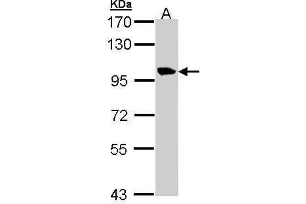 TMEM67 Antikörper  (Center)