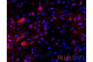 IHC-Fr Image OLIG1 antibody [C2C3] detects OLIG1 protein on adult mouse brain by immunohistochemical analysis. (OLIG1 Antikörper  (C-Term))