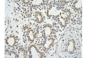 Rabbit Anti-WDR12 antibody         Paraffin Embedded Tissue:  Human Lung    cell Cellular Data:  alveolar cell    Antibody Concentration:  4.