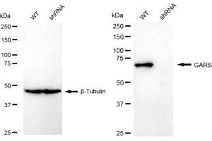 Western blotting analysis using GARS antibody (ABIN7798784). (Rekombinanter GARS Antikörper)